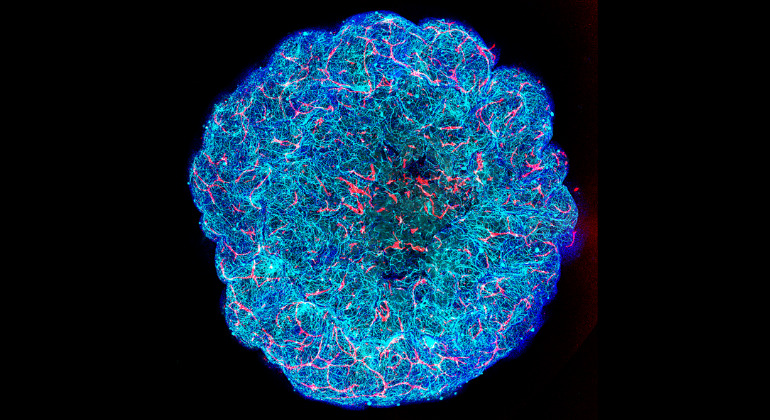 Alzheimer’s best-known risk gene turns brain vessel cells into scar ...