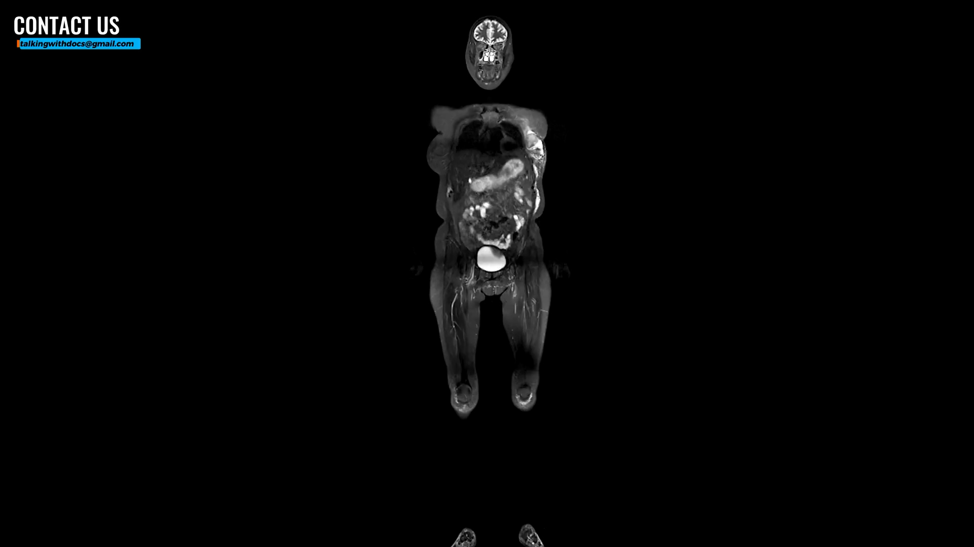 Thinking about a whole-body MRI? What doctors want you to consider first