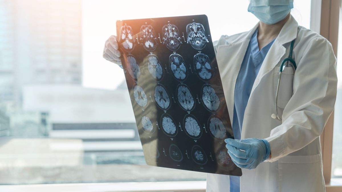 Seus hábitos podem aumentar o risco de AVC? Saiba como prevenir doença