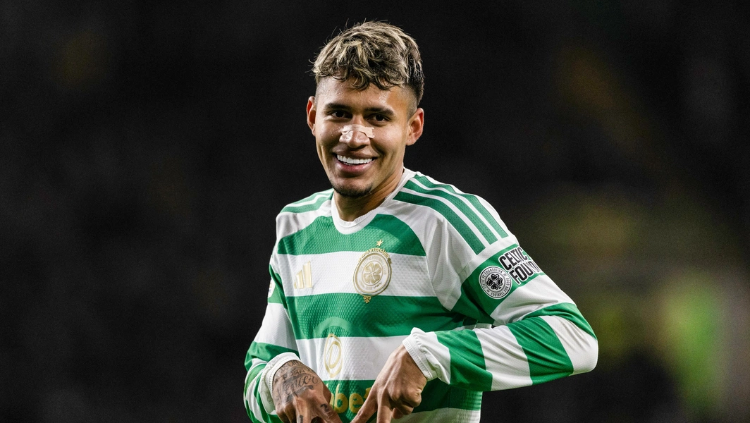 O’Neill sees positives as Celtic hold Dundee United in 2-2 draw