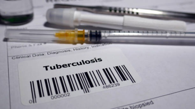 TB treatment in 4 months with 3 or fewer injections? WHO pushes for ...