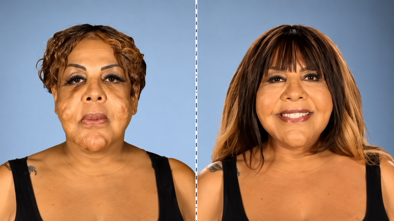 Plastic surgeon reacts to concrete facial injections