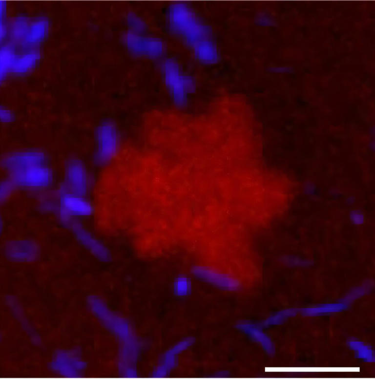 Zombie bacteria keep building DNA after death