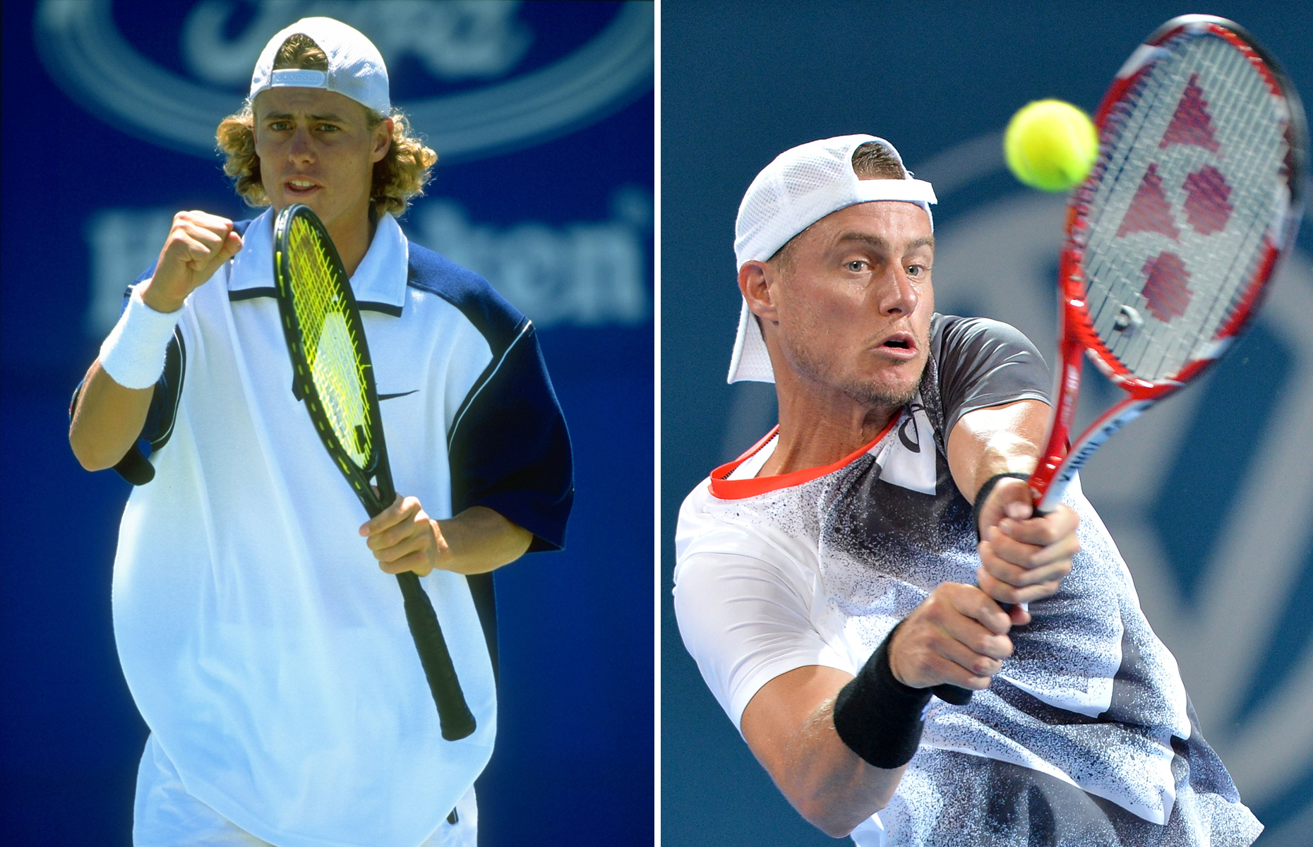 一流アスリートの今と昔