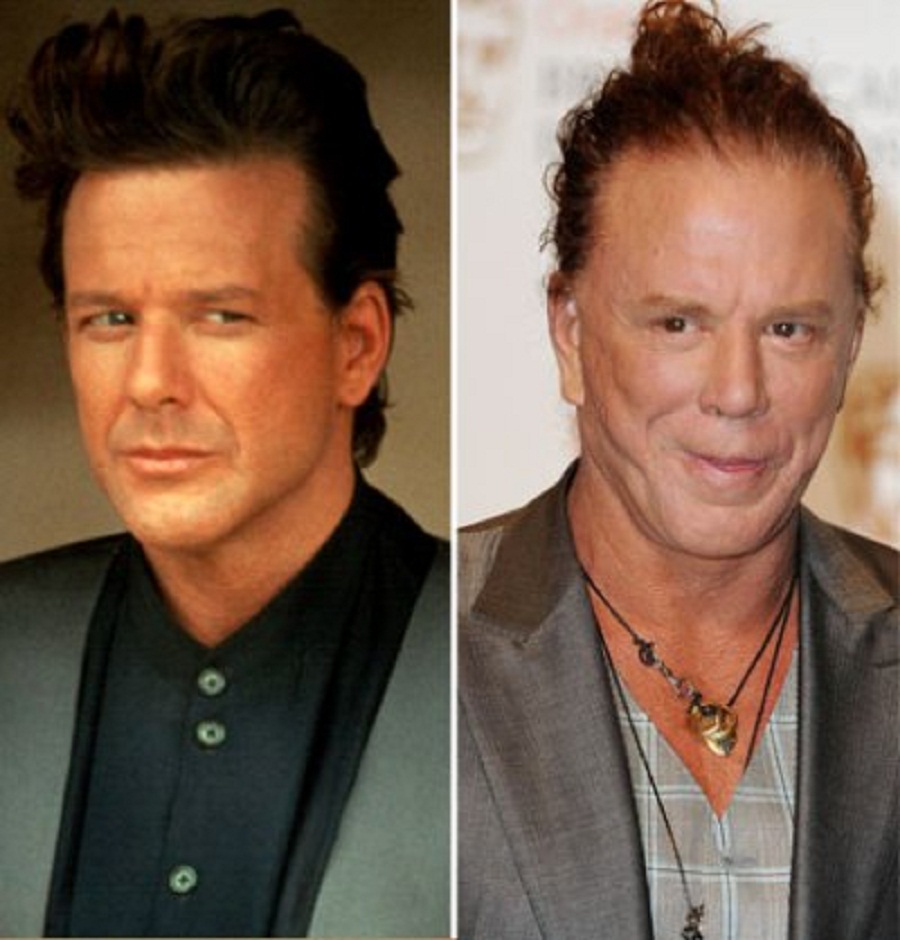Mickey Rourke: Croyez-le ou non, il fut un temps où Mickey Rourke était l’un des hommes les plus désirables de la planète. Avant que la folie Cinquante nuances de Grey s’empare des esprits des plus de 100 millions de femmes, le film 9 semaines ½, sorti en 1986, nous invitait dans l’univers d’une jeune femme qui accepte de se plier à des jeux sexuels de plus en plus dominateurs avec un homme mystérieux qu’elle a rencontré par hasard dans la rue. Le film a propulsé Mickey Rourke au rang des plus grands sex-symbols des années 80, mais malheureusement, ça s’est rapidement gâté avec le temps. Ses multiples interventions de chirurgie esthétique l’ont rendu méconnaissable au fil des années.