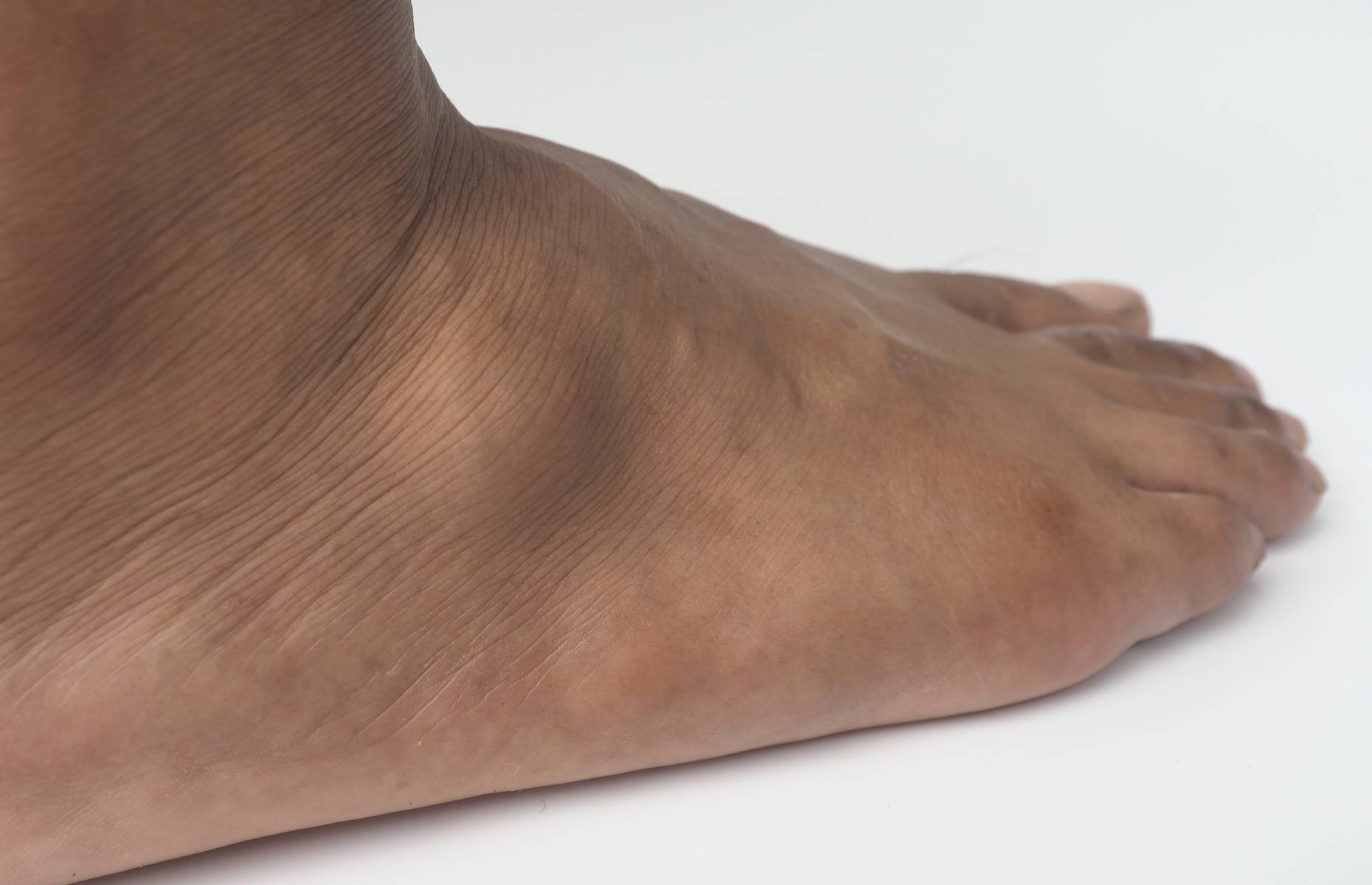 What can your feet tell you about your health?