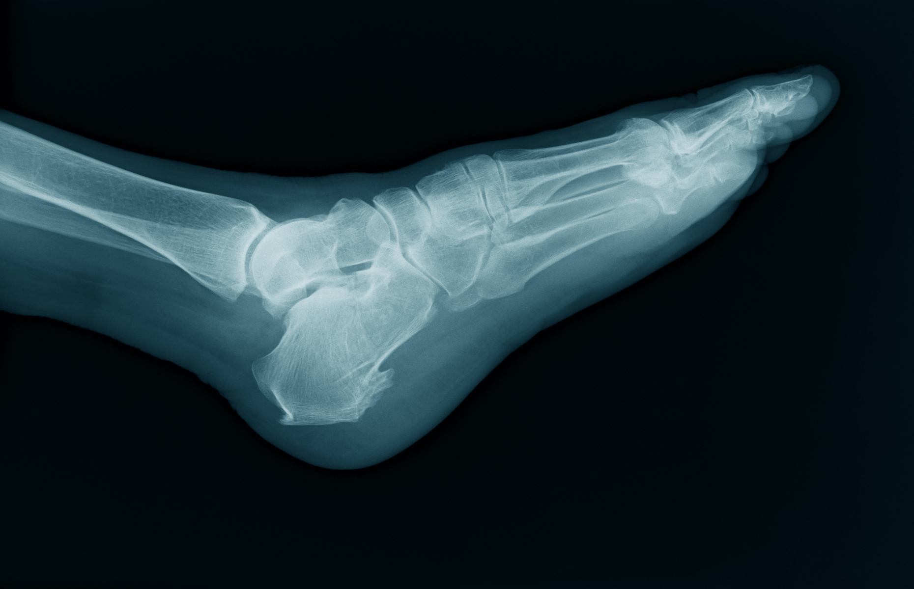 What can your feet tell you about your health?