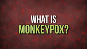 a close up of a sign: What is Monkeypox?