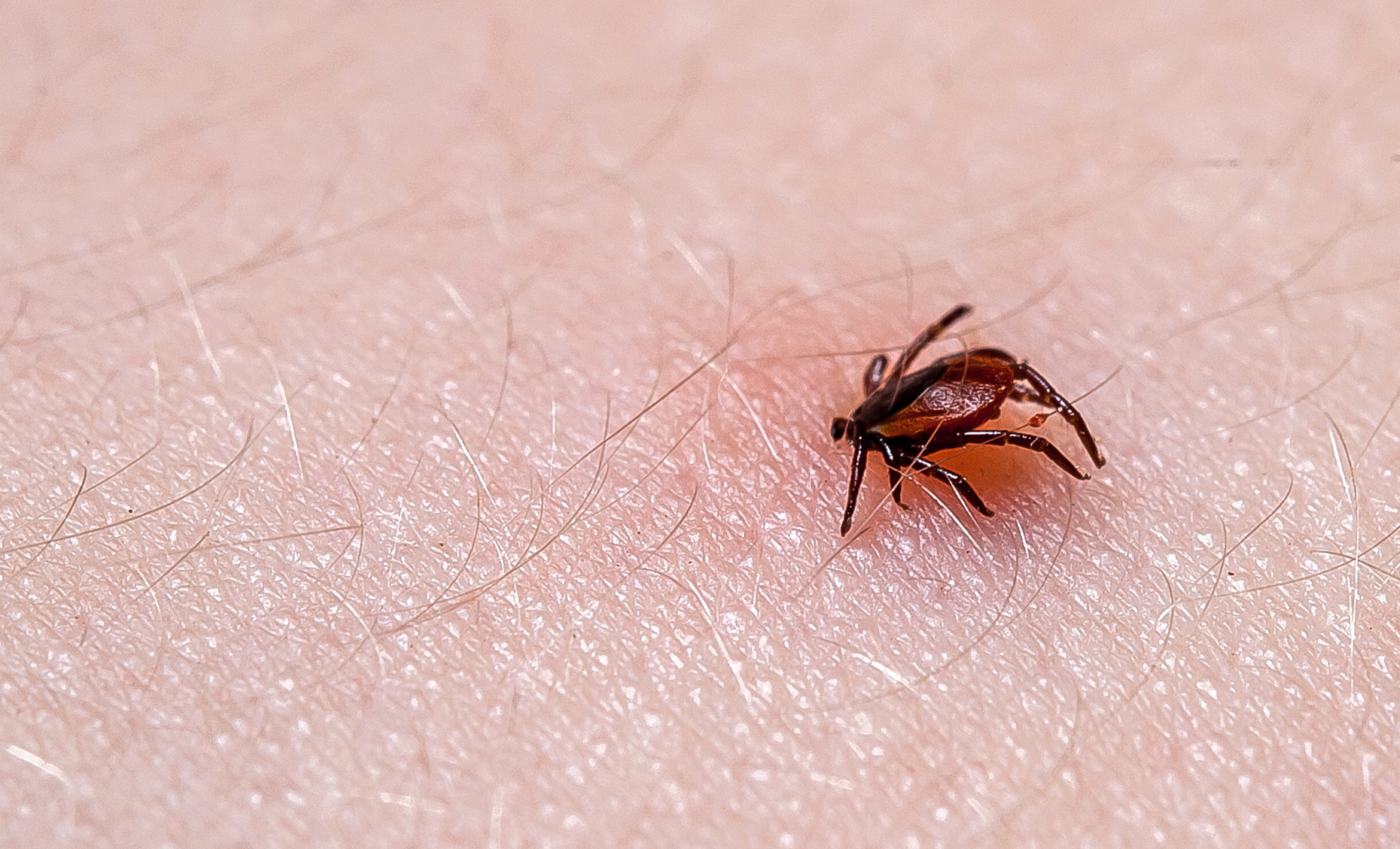 20 facts about Lyme disease