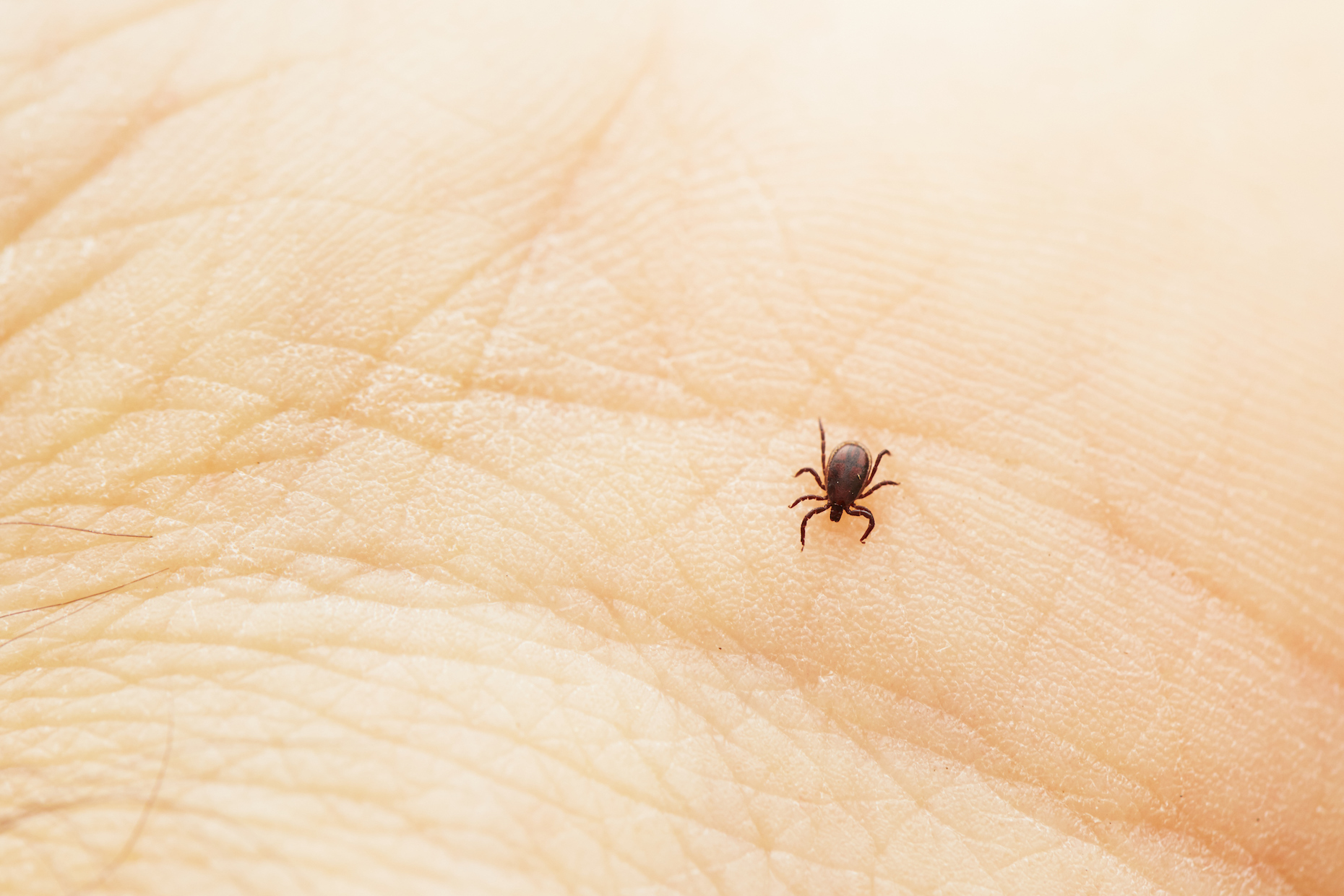 Everything you need to know about Lyme disease