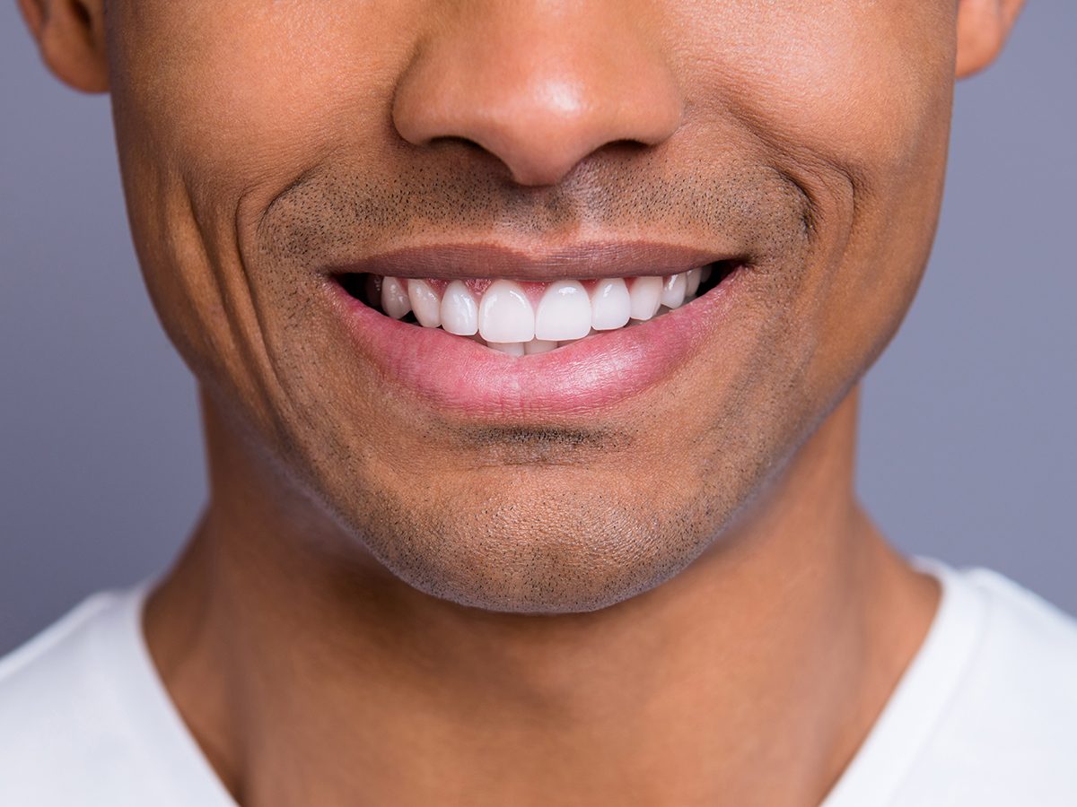 7 Signs of Disease Your Teeth Can Reveal