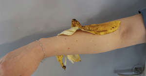 Si frotas una cáscara de plátano en tu brazo, lograrás un efecto increíble