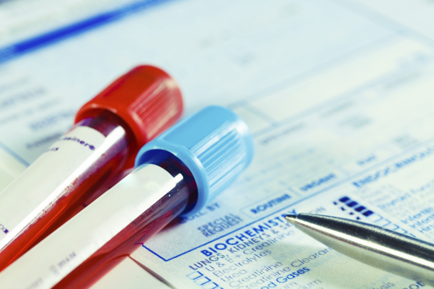 Slide 8 de 10: Se consumido pela manh&atilde;, talvez dentro de um ch&aacute;, ajuda a reduzir o a&ccedil;&uacute;car no sangue.