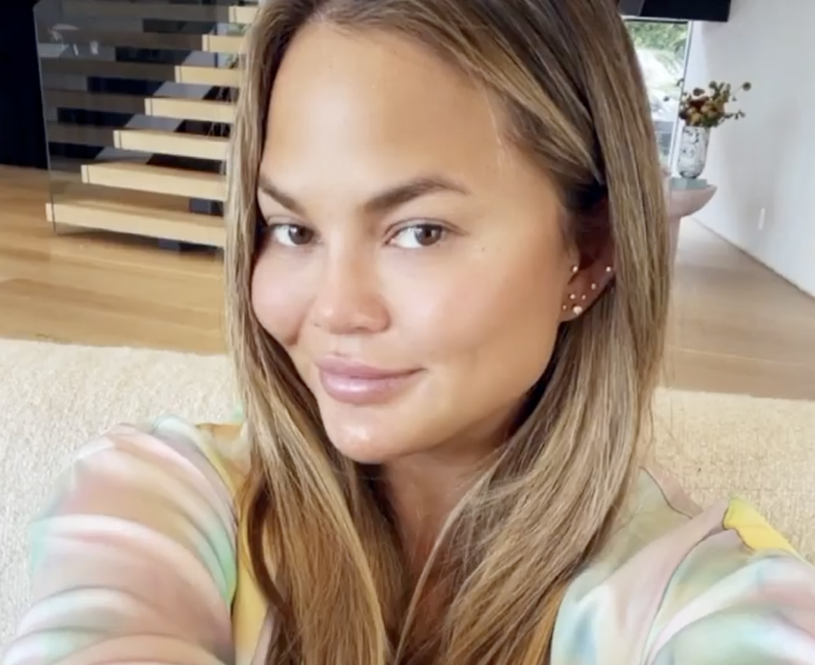 <p>Model and cookbook author <a href="https://www.wonderwall.com/celebrity/profiles/overview/chrissy-teigen-1561.article">Chrissy Teigen</a> took to her Instagram Story in November 2021 to share with her fans that she'd undergone hair transplant surgery... on her eyebrows. Unhappy with the thickness of her brows after over-plucking them when she was younger, she turned to plastic surgeons Jason Diamond from "Dr. 90210" fame and Jason P. Champagne. "I never wear makeup if I can avoid it so I was excited for this eyebrow transplant surgery where they take hairs from the back of your head!!!" she told her Instagram followers. Keep reading to see the results...</p>