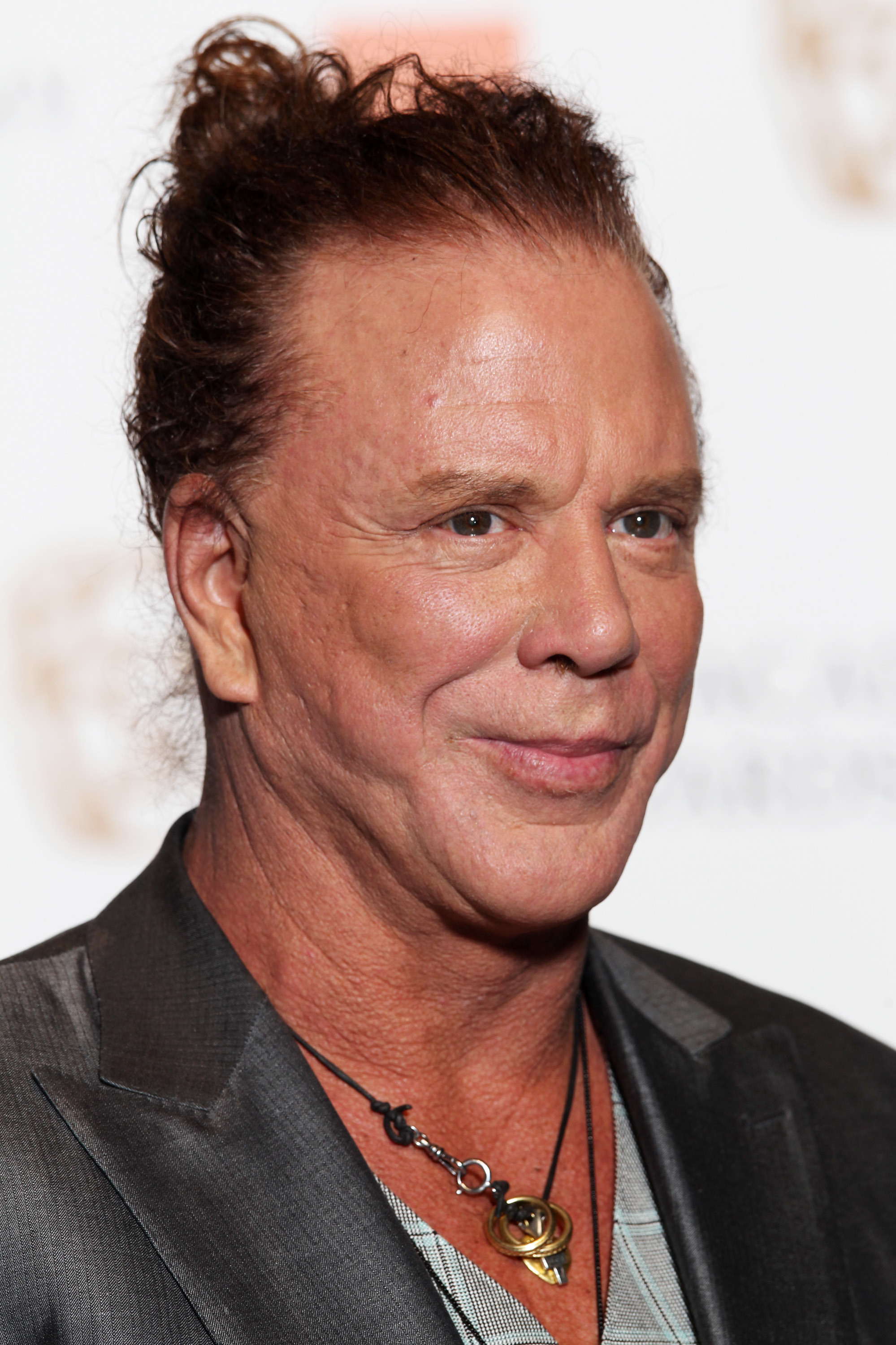 <p>Mickey Rourke (seen here in 2010) went under the knife to get reconstructive surgery after his face was badly damaged during his stint as a boxer. Unfortunately, he went to the wrong doctor. "Most of it was to mend the mess of my face because of the boxing, but I went to the wrong guy to put my face back together," he told MailOnline in 2009. "I had my nose broken twice. I had five operations on my nose and one on a smashed cheekbone."</p>