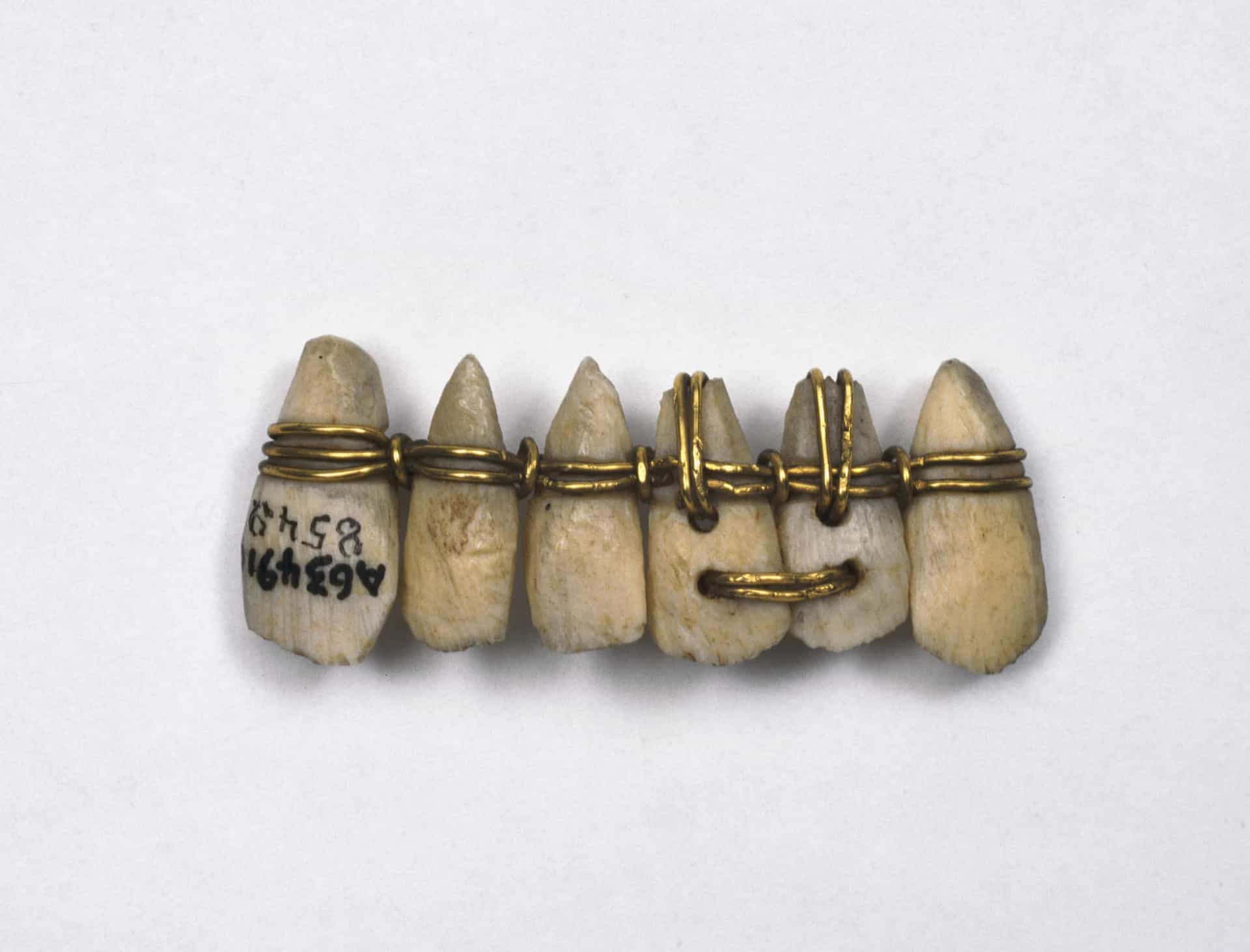 grills-to-gems-the-history-of-tooth-bling