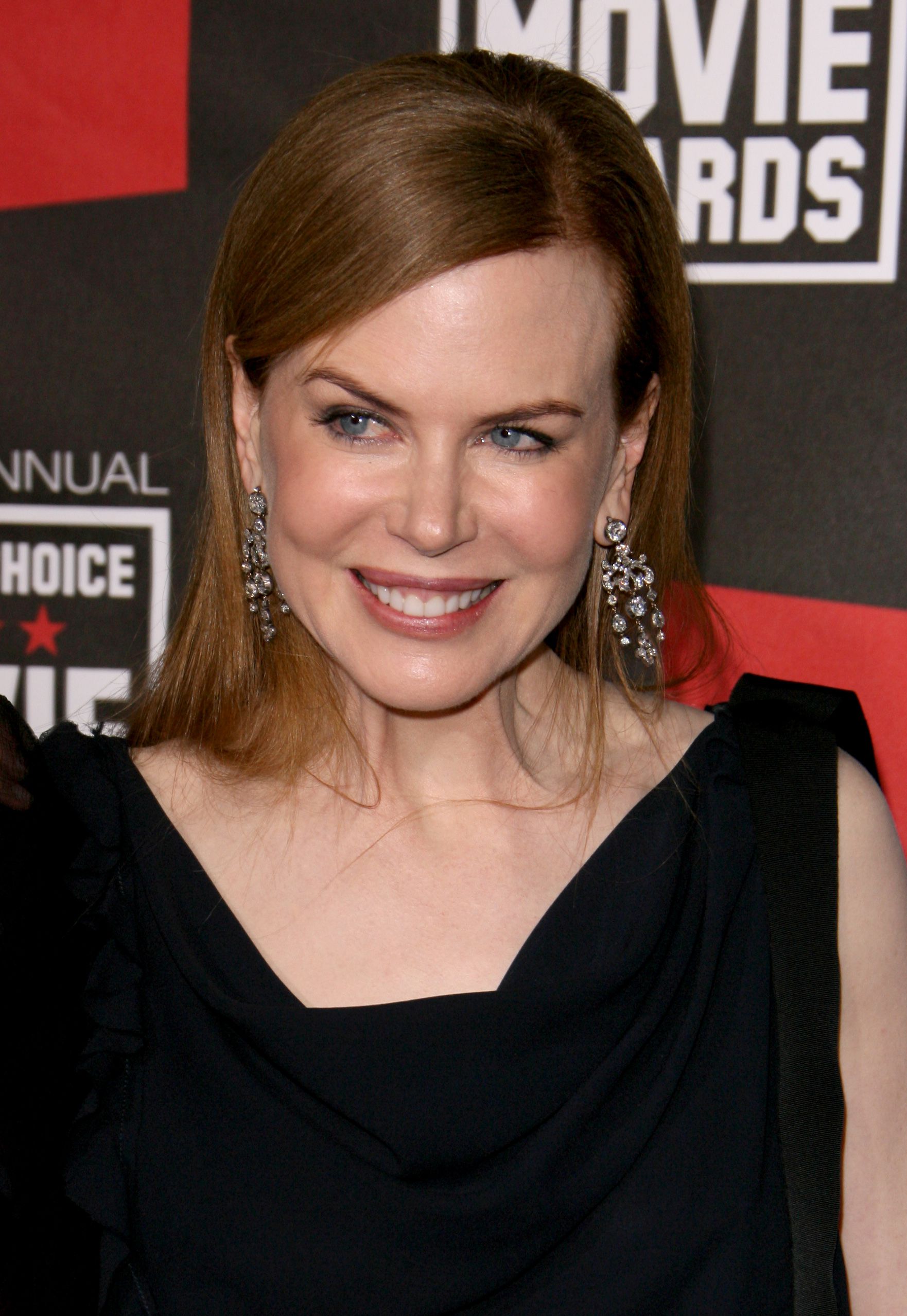 <p>The change in <a href="https://www.wonderwall.com/celebrity/profiles/overview/nicole-kidman-364.article">Nicole Kidman</a>'s look could be attributed to the gradual loss of baby fat, but the actress (pictured in 2011) has admitted that she once had a Botox habit. We're glad she gave it up -- because she looks better when she can move her face, as she admitted herself in 2013. "I did try Botox, unfortunately, but I got out of it and now I can finally move my face again," she told the Italian newspaper La Repubblica, calling the decision to get injections an "unfortunate move."</p>