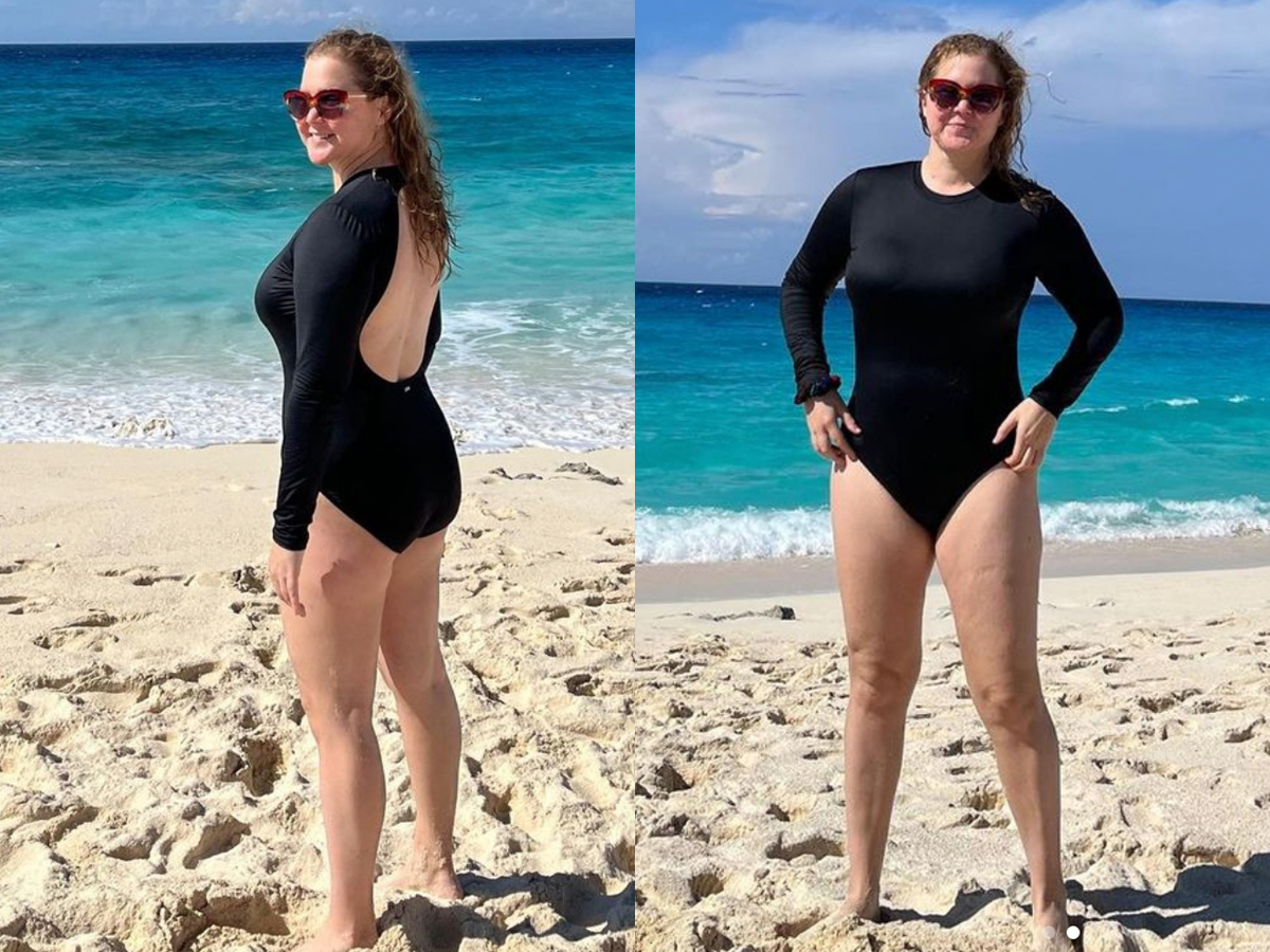 <p>In January 2022, <a href="https://www.wonderwall.com/celebrity/profiles/overview/amy-schumer-1586.article">Amy Schumer</a> took to Instagram to share two <a href="https://www.instagram.com/p/CY330tCur4c/">photos</a> of herself lookin' good in a black swimsuit on a beach. In the caption, the comedian -- who in 2021 had her uterus and appendix removed as a result of her painful battle with endometriosis -- revealed that she also underwent liposuction after healing. "I feel good. Finally. It's been a journey thanks for helping me get my strength back @seckinmd (endo) @jordanternermd (lipo) never thought i would do anything but talk to me after your uterus doesn't contract for 2.5 years and you turn 40. @paulvincent22 vickie Lee (acupuncture) my girl Nicole from the tox my friends and fam. Let's go!" Amy wrote, adding in a message on her Instagram Story that she weighed 170 pounds. A few months later in a March 2022 interview with <a href="https://www.hollywoodreporter.com/tv/tv-features/amy-schumer-interview-life-and-beth-oscars-1235106625/">The Hollywood Reporter</a>, she shared more about having lipo: "It's not about needing to be slamming, because I've never been famous for being hot, but I'd reached a place where I was tired of looking at myself in the mirror," she explained, adding that she knew "grilled chicken and walks" weren't going to fix the area above her C-section scar. "Everybody on camera is doing this s***, I just wanted to be real about it."</p>
