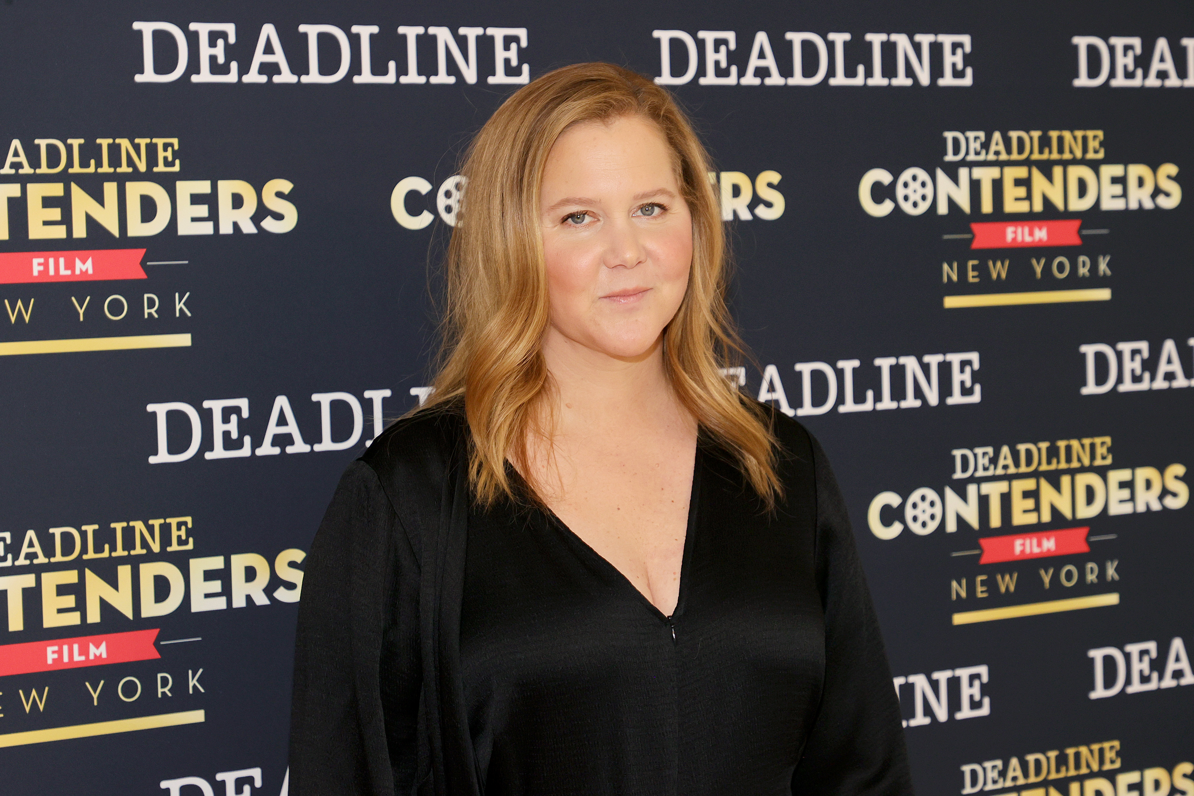 <p>Comedian <a href="https://www.wonderwall.com/celebrity/profiles/overview/amy-schumer-1586.article">Amy Schumer</a> took to Instagram in December 2021 to reveal that she was unhappy with facial fillers she got earlier in the year and wanted them dissolved. A month later, she further revealed she'd had liposuction too and soon detailed why she did it...</p>