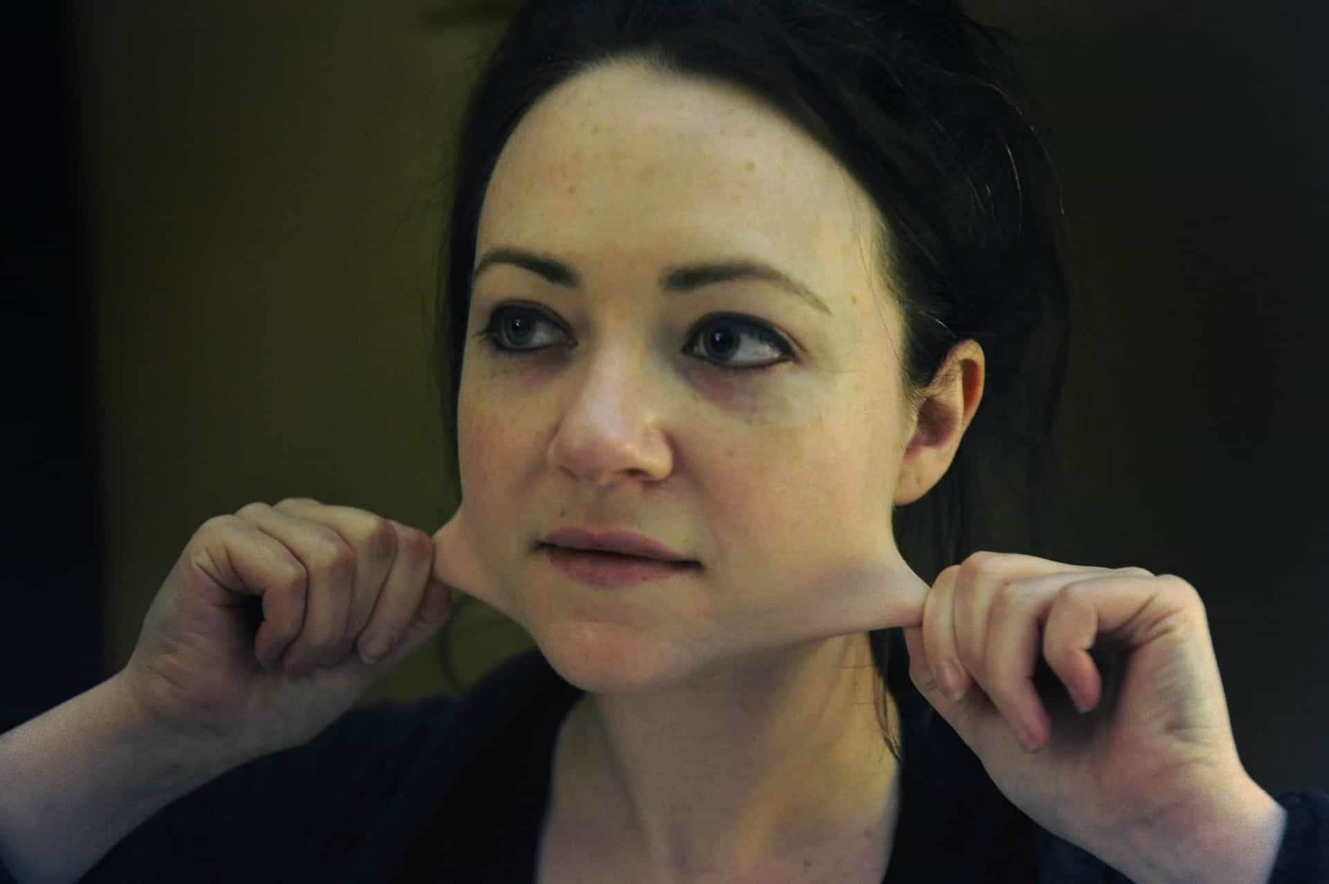 Understanding EhlersDanlos syndromes