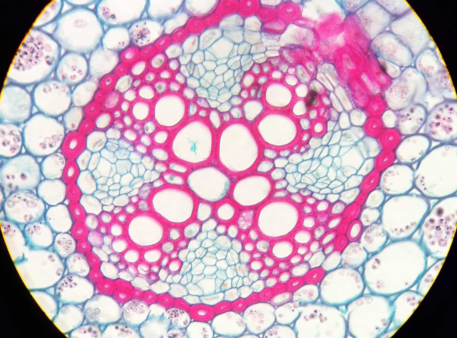 Understanding EhlersDanlos syndromes