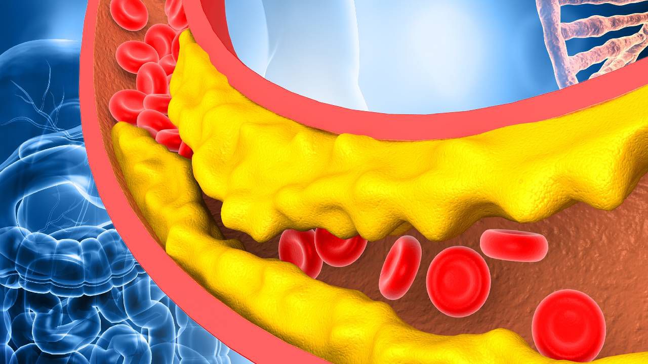 ¿cómo expulsa el cuerpo el colesterol de la sangre?