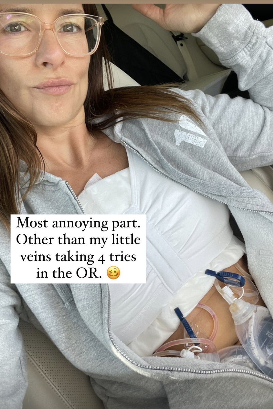 <p><span>Danica Patrick revealed in a lengthy Instagram <a href="https://www.instagram.com/p/Cc8HQGNruIJ/">post</a> in April 2022 that she'd just had her breast implants removed -- and within hours, she'd already started to feel better. "The condition that is not universally recognized is called breast implant illness. Leave it up to the good folks at these drug companies who are selling them to say they are safe. Look it up if you are struggling or know someone that is. The common denominator is you have conditions that can't be resolved. For me this is true. I have tried 3 drs and 6-8 levels of thyroid meds, a 90 day gut protocol, and chelation to get rid of heavy metals and up to 30 pills a day.... with no resolution. I haven't felt or looked any different," she explained. "There are a host of issues that women have dealt with and I have many, but not all. After watching over 100 stories on YouTube.... my belief is, it's not if but when you develop symptoms. Some are right away, others are over 15 years later. Silicone is a foreign object and leaches chemicals (look up that huge list!) that's why the body produces a capsule around it." Danica concluded, "If this post helps just one get to the root of their issues, it did its job" and vowed to keep fans posted on her progress via social media. </span></p>