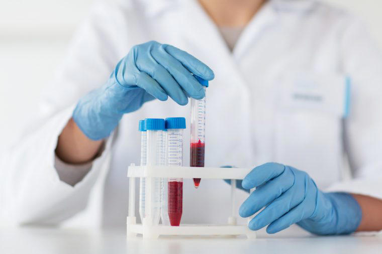 science, chemistry, biology, medicine and people concept - close up of young female scientist holding tube with blood sample making and test or research in clinical laboratory