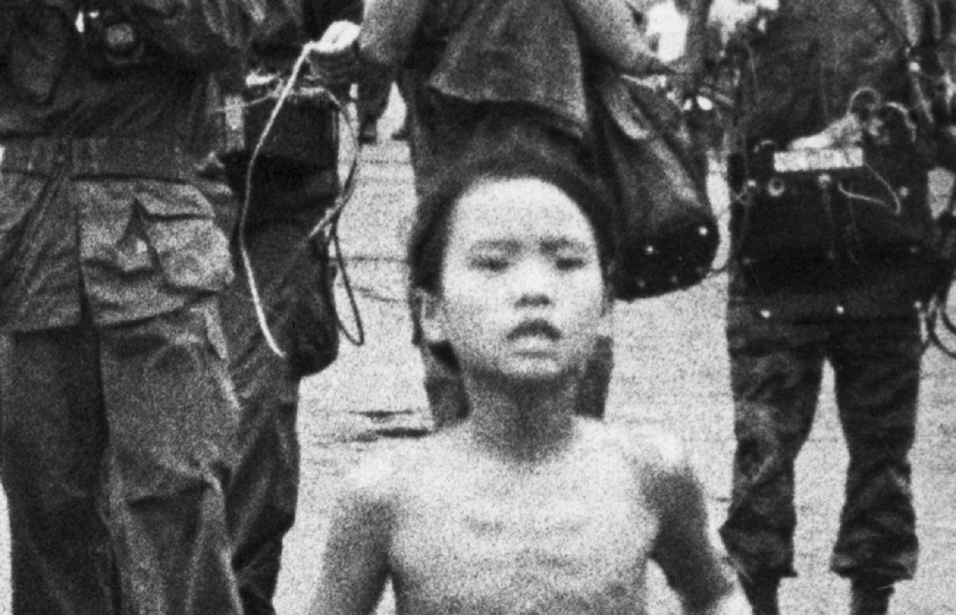 Napalm Girl 50 Years Later Receives Final Treatment