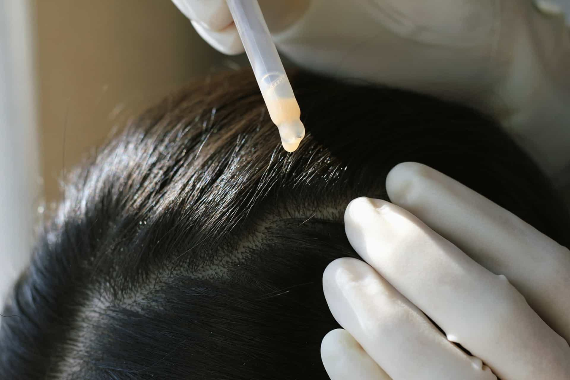 Дерматолог головы. Scalp Exam. Лечение волос головы у дерматолога в Киселевске.