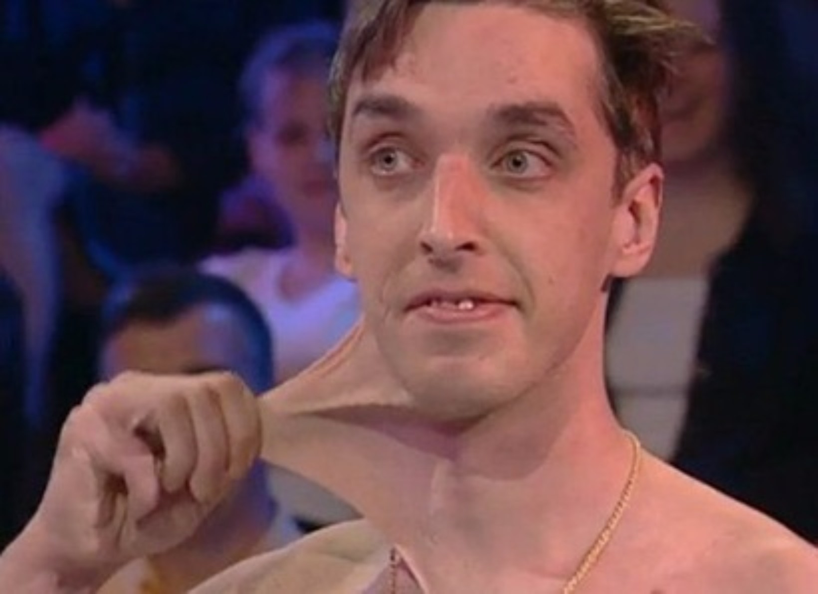 Slide 10 of 28: Garry TurnerWe've met Rubberboy, but this is the real elastic man. Garry can manipulate his skin to such a degree that he is able to serve drinks on a tray solely made from his stretched skin. This condition is due to a certain quantity of collagen present in the body.