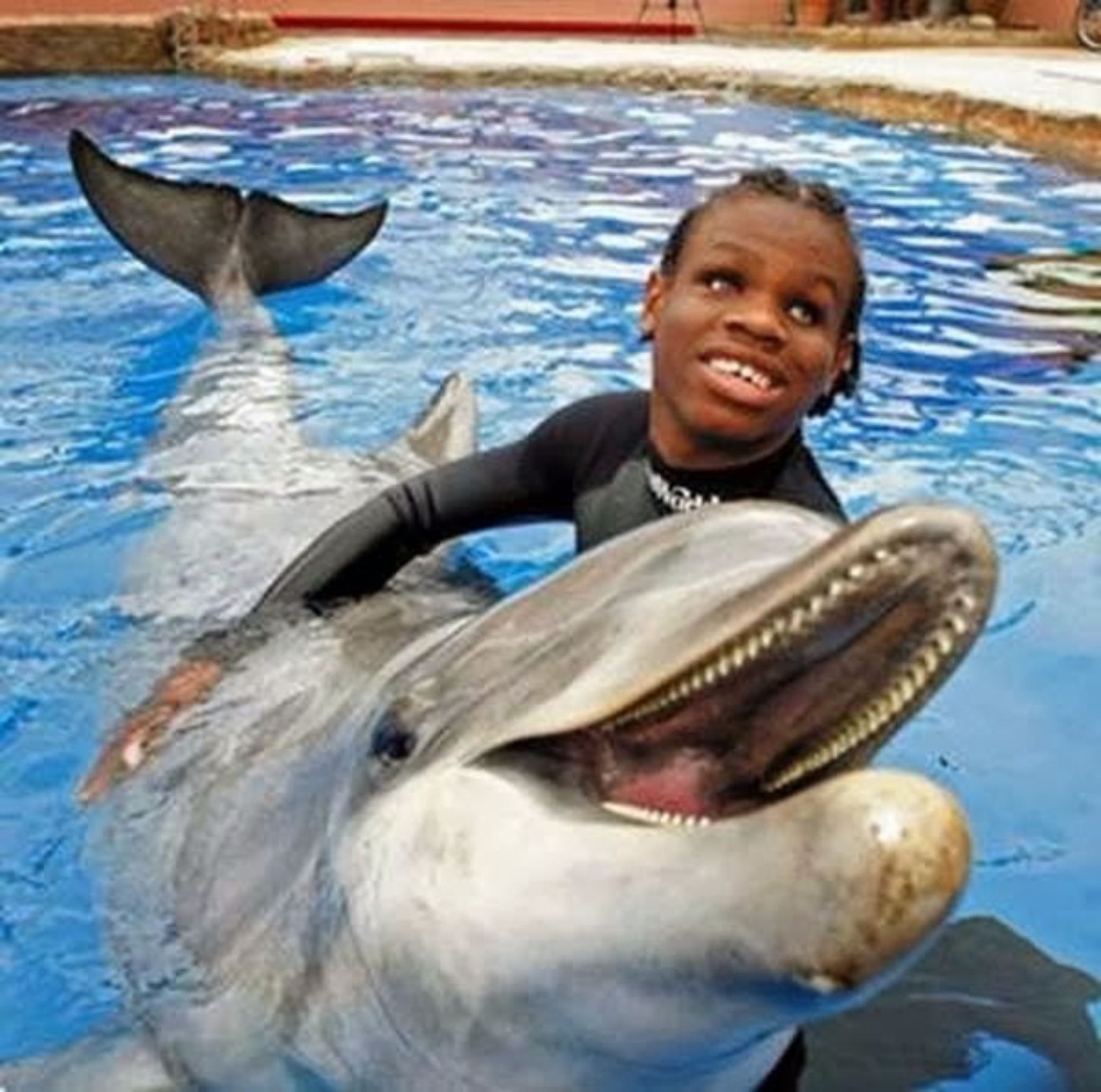 Slide 4 of 28: Ben UnderwoodDiagnosed with eye cancer when he was two years old, Ben had both eyes removed when he was three. However, he developed an excellent echolocation; the same skill bats use to navigate at night. By making sounds with his tongue he could feel the vibrations of the objects around him. Unfortunately, Ben passed away in 2007, victim of the same cancer that took both of his eyes.