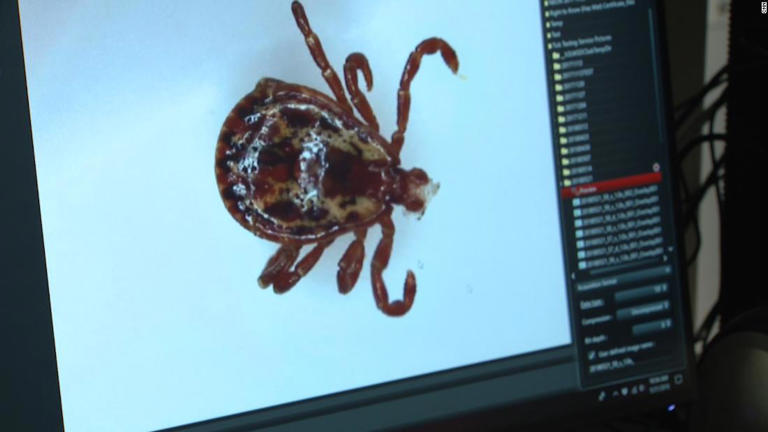 Survivor of near-fatal tick bite has a lesson for summer