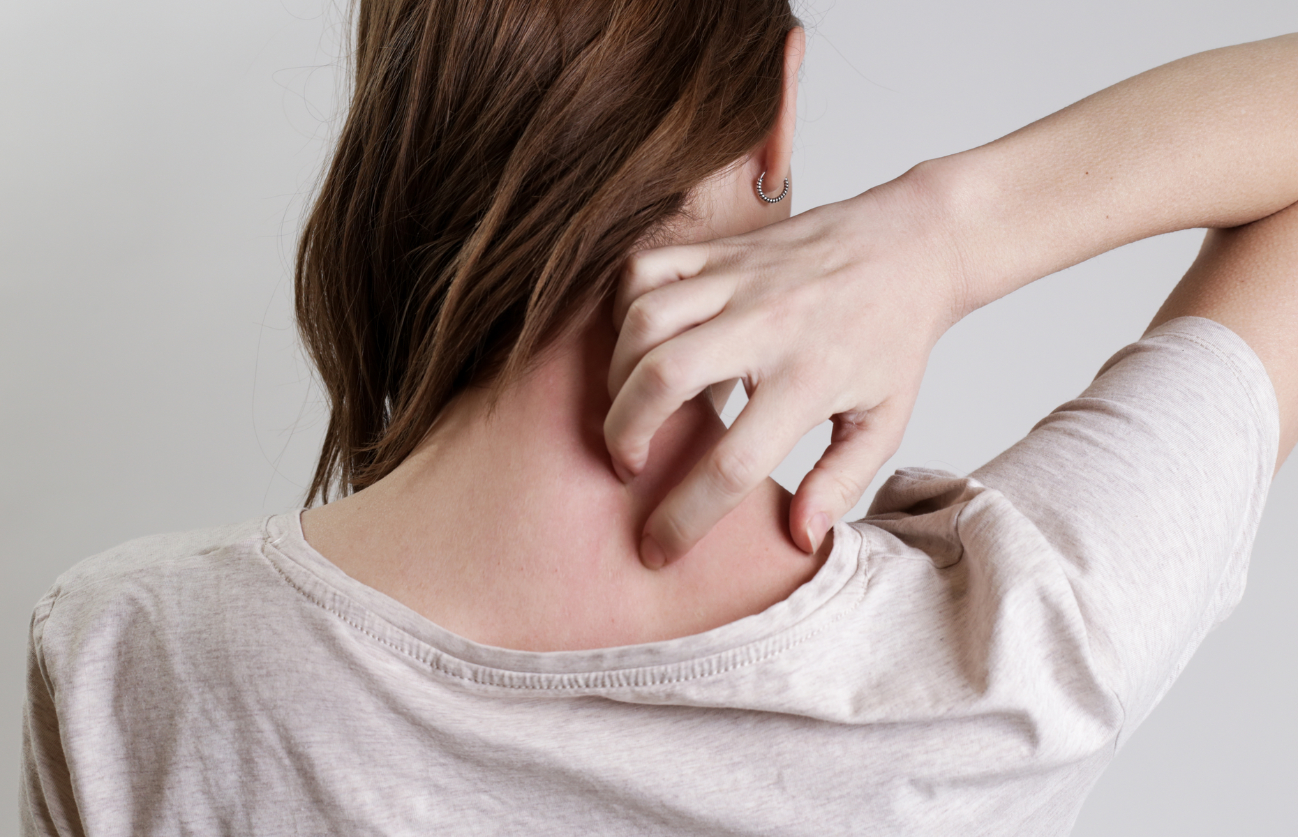 Shingles what are the symptoms and treatment?