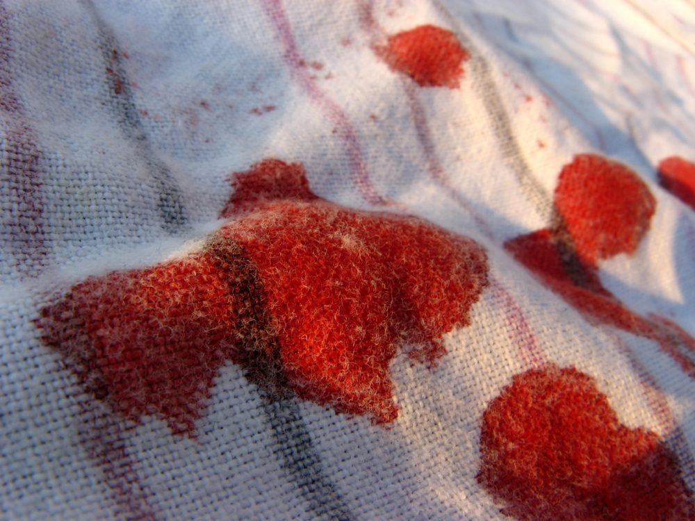 <p>Blood, cola, hair dye, ketchup, and wine stains on washable cotton blends should be treated as soon as possible (that is, within 24 hours). Sponge the area with undiluted vinegar and launder immediately afterward. For severe stains, add 1-2 cups vinegar to the wash cycle as well. Older, set-in stains will often come out in the wash after being pretreated with a solution of 3 tablespoons white vinegar and 2 tablespoons liquid detergent in 1 quart (1 liter) warm water. Rub the solution into the stain, then blot it dry before washing. Learn more about <a href="https://www.rd.com/article/how-to-remove-blood-stains/">how to remove blood stains</a>.</p>