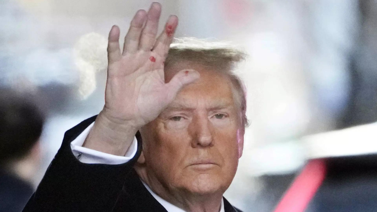 Red spots on Trump's hands spark syphilis rumours