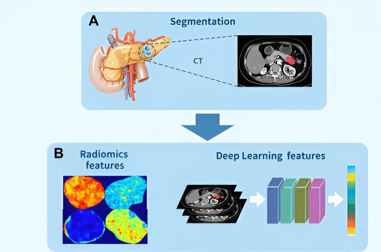 Ct Based Radiomics Deep Learning To Predict Lymph Node Metastasis In Tumors 5899