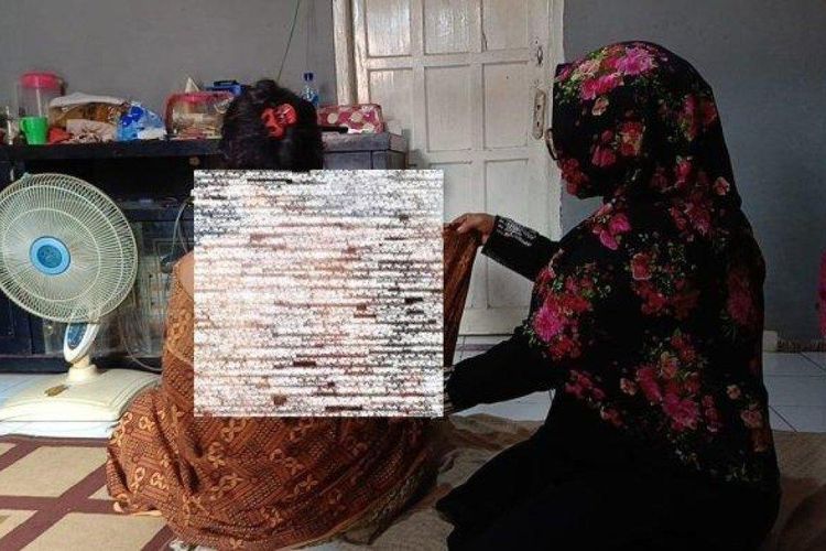 Kulit Sampai Melepuh, Suami Di Cianjur Tega Siram Istri Dan Anak Dengan ...