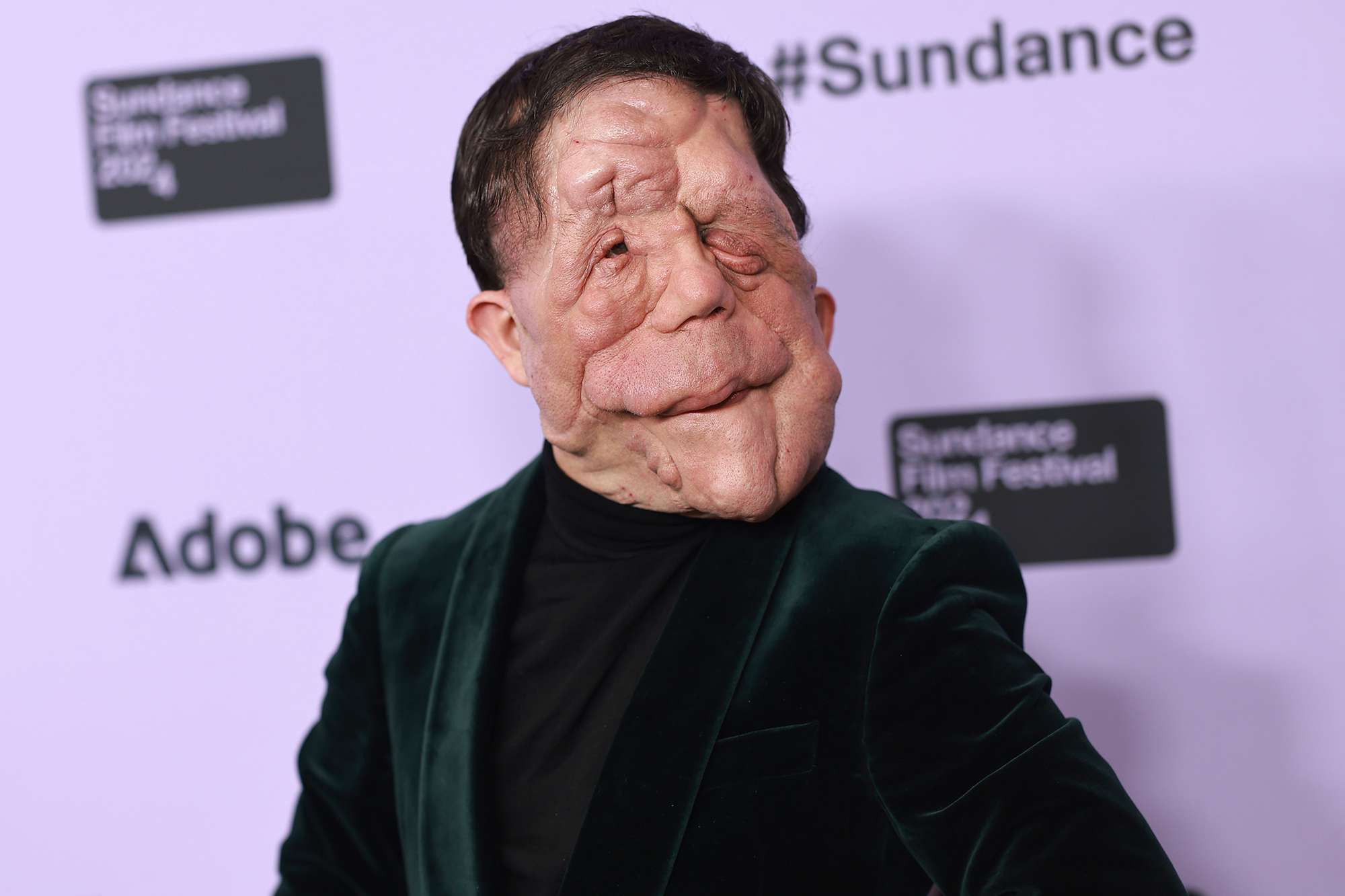 adam pearson speaks out against how actors with disabilities are only offered certain types of roles: 'lazy writing'