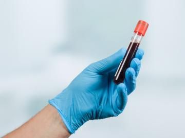long covid im blut nachweisbar: forscher finden spuren