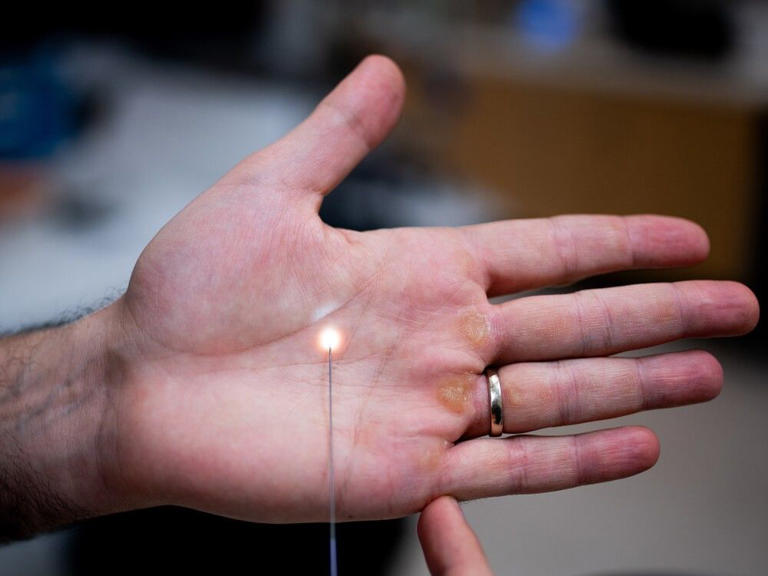 How a really tiny camera could revolutionize stroke treatment