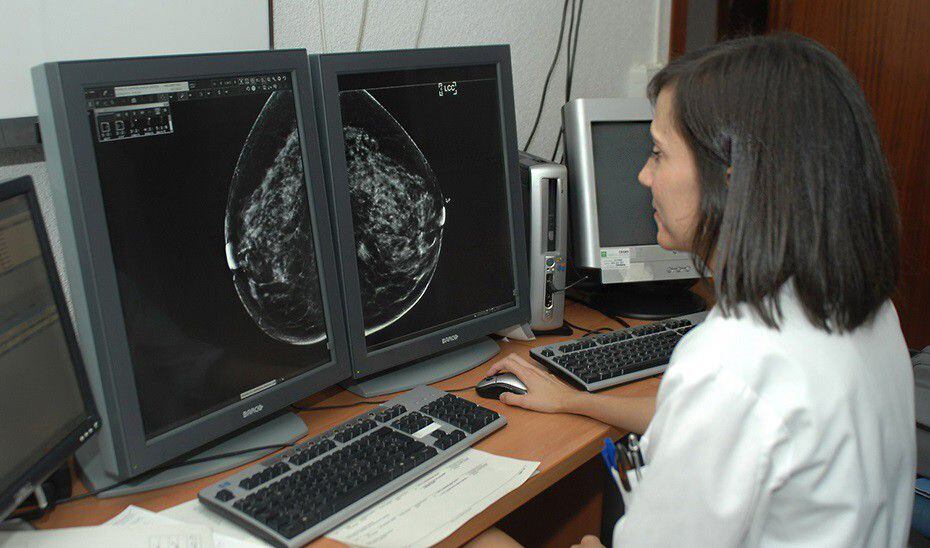 la detección precoz es fundamental: cáncer de mama entre los 3 más mortales de chile