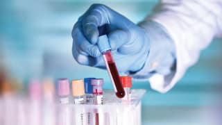 6 Important Blood Tests