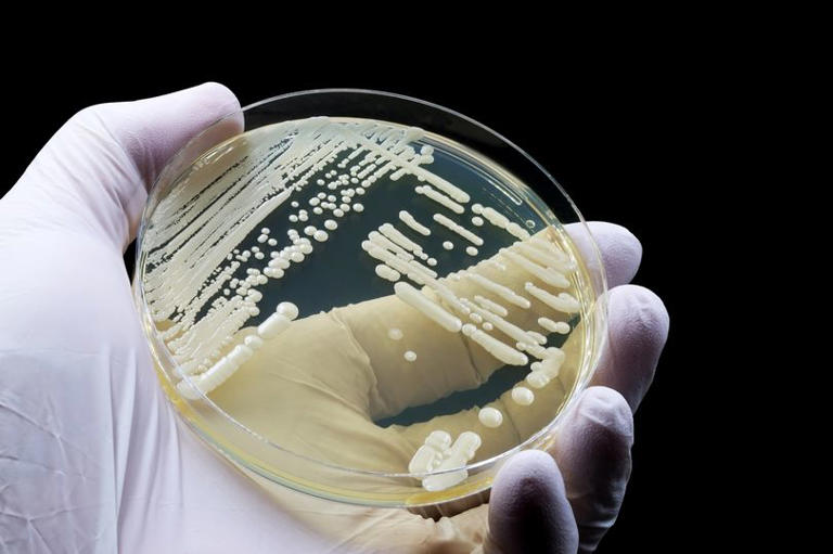 Deadly Candida Auris Fungal Infection Spreading Rapidly Across Us With 60 Death Rate 