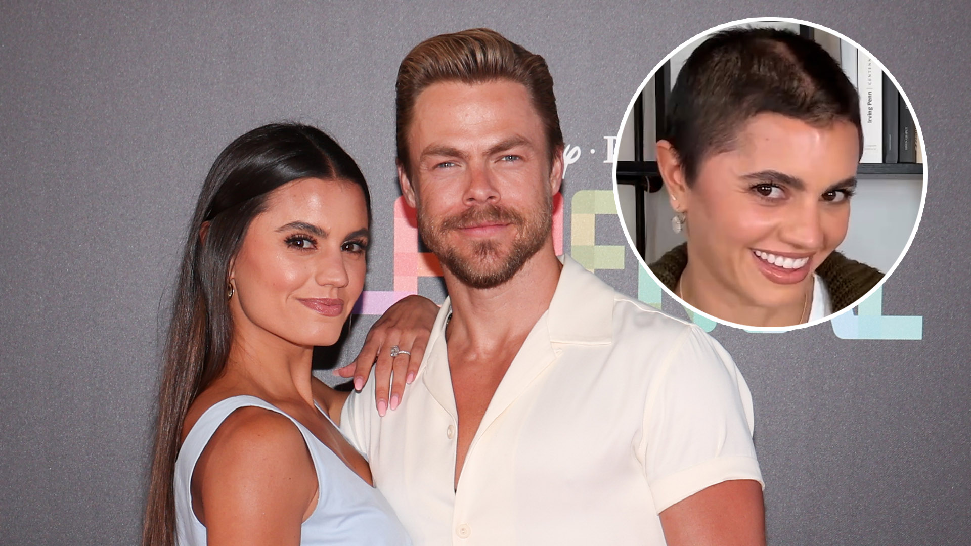 Derek Hough's Wife Hayley Erbert Shows Skull Surgery Scar While Sharing ...