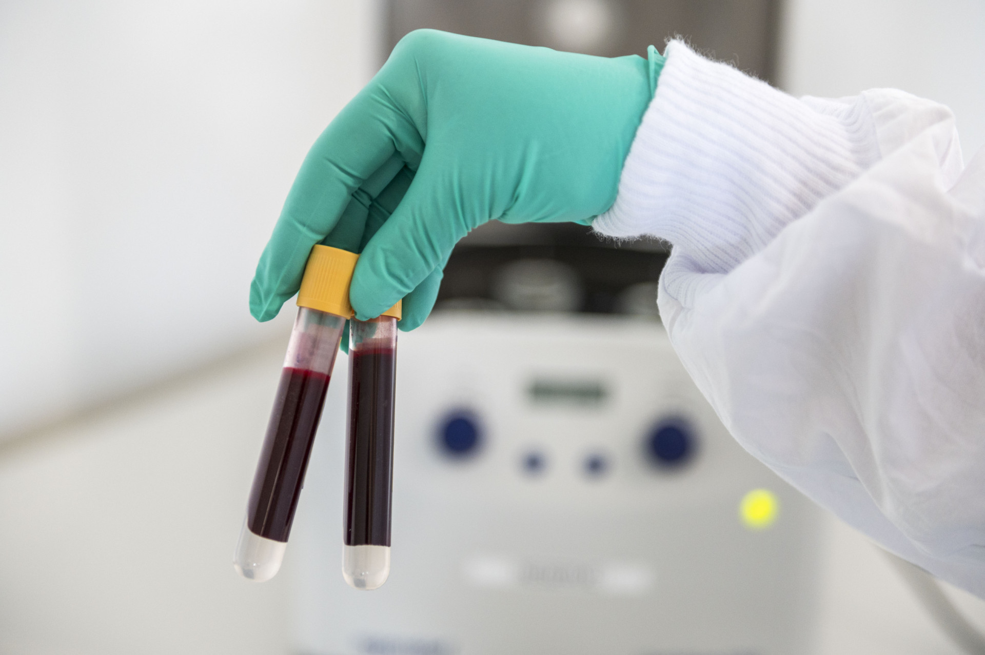 Bloed is blauw voordat het zuurstof krijgt