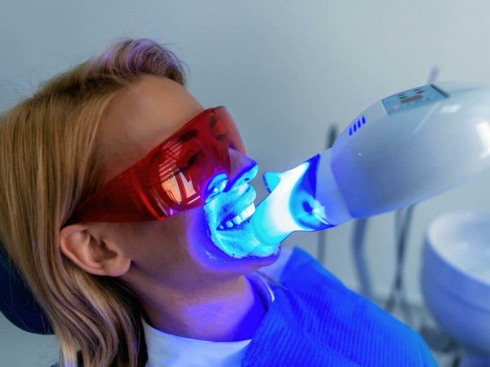 tendencias naturales en el blanqueamiento dental
