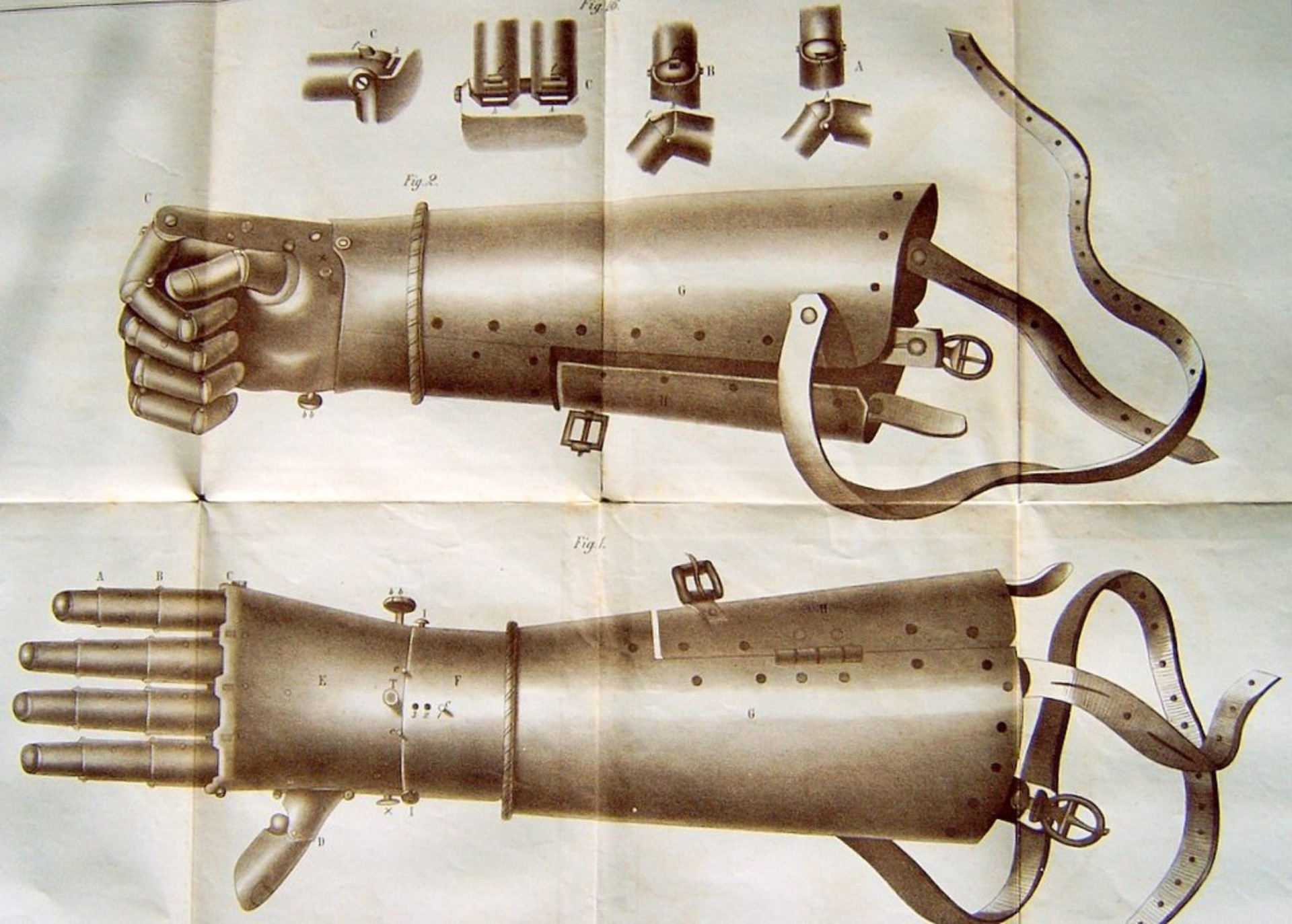 From Limb To Limb: A History Of Prosthetics