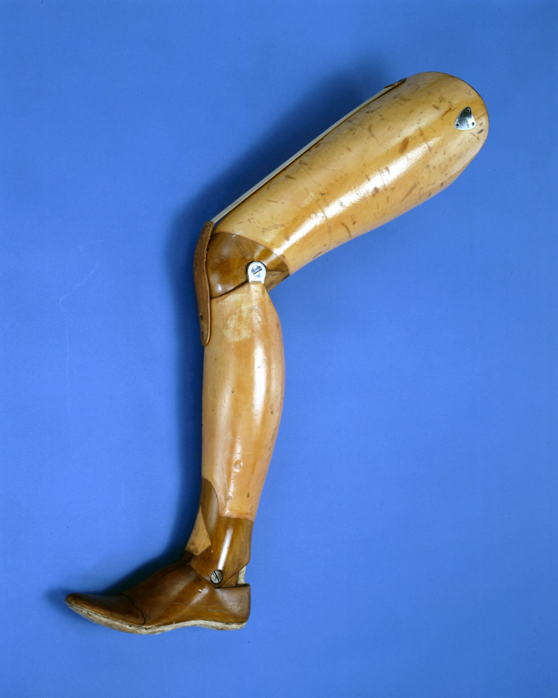 From Limb To Limb: A History Of Prosthetics