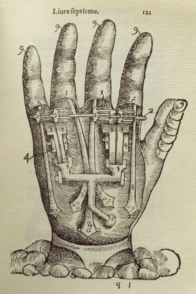 From Limb To Limb: A History Of Prosthetics